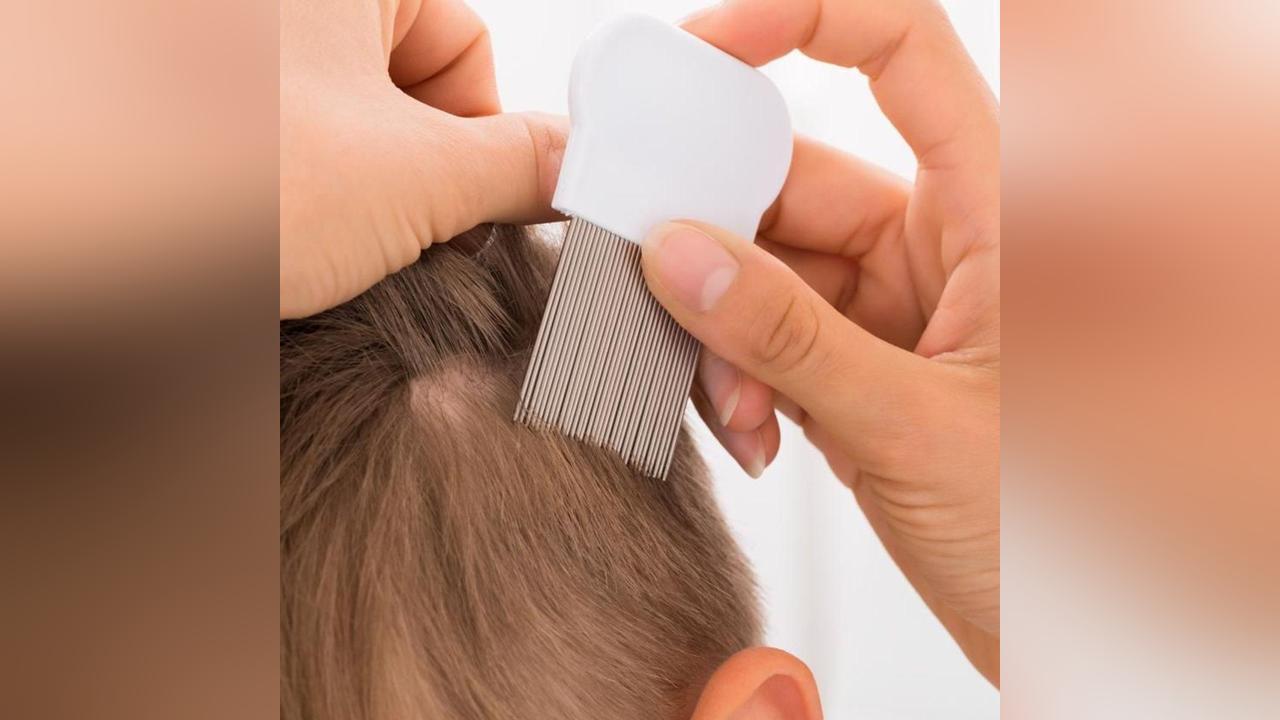 Que faire contre les poux et les lentes ? Que faire contre les poux et les lentes ?