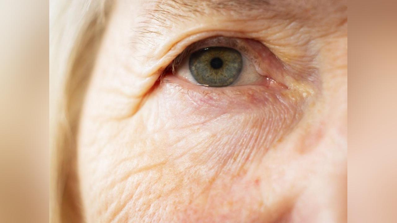 Le Vieillissement se Voit dans les Yeux Le Vieillissement se Voit dans les Yeux