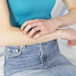 Les Démangeaisons Sont-Elles une Forme de Douleur? Les Démangeaisons Sont-Elles une Forme de Douleur?