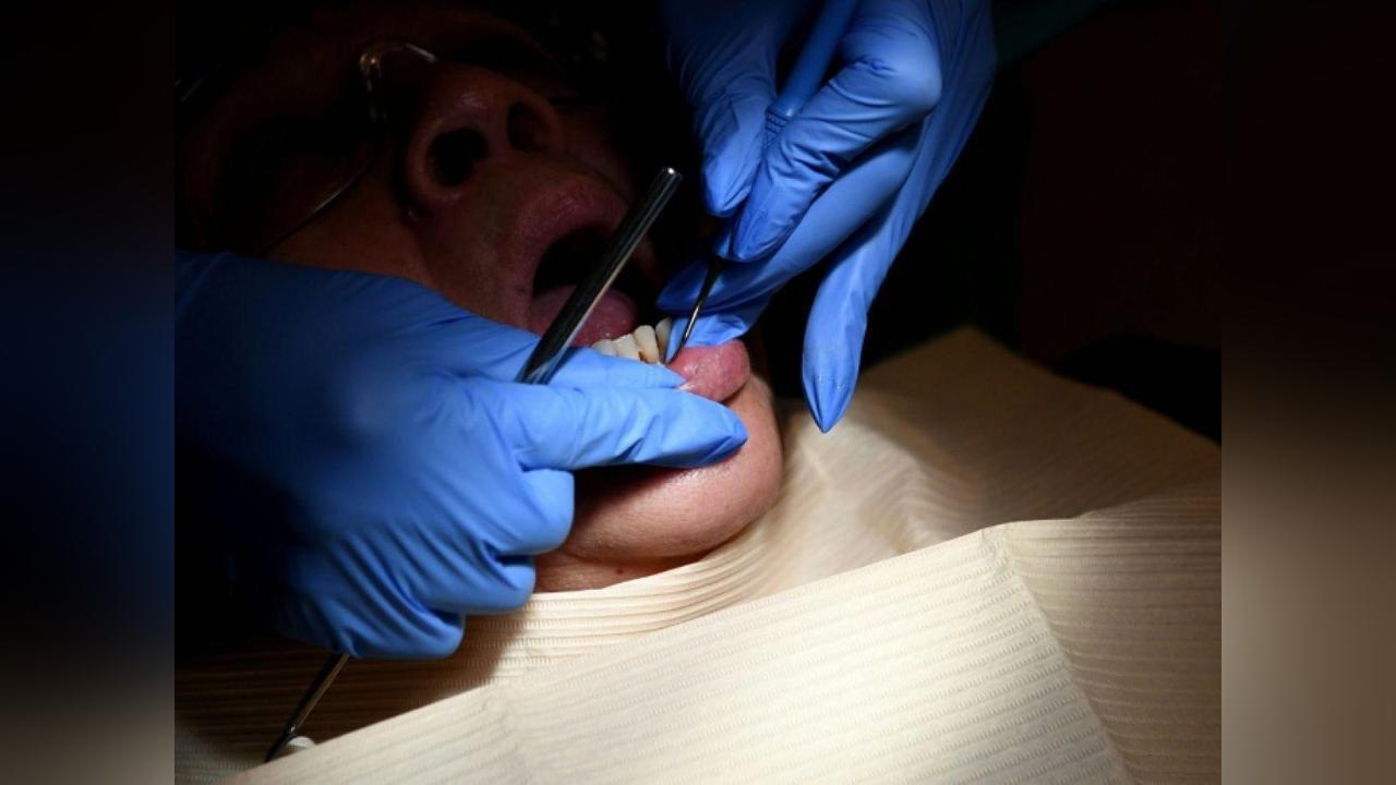 Caries Dentaires vers le Remboursement de Quatre Traitements Caries Dentaires vers le Remboursement de Quatre Traitements