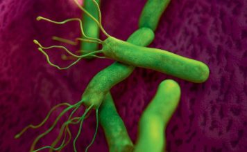 Ulcères de L’Estomac et Helicobacter Pylori Ulcères de L’Estomac et Helicobacter Pylori