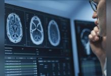 IRM Cérébrale: IA Améliore Détection des Anomalies IRM Cérébrale: IA Améliore Détection des Anomalies