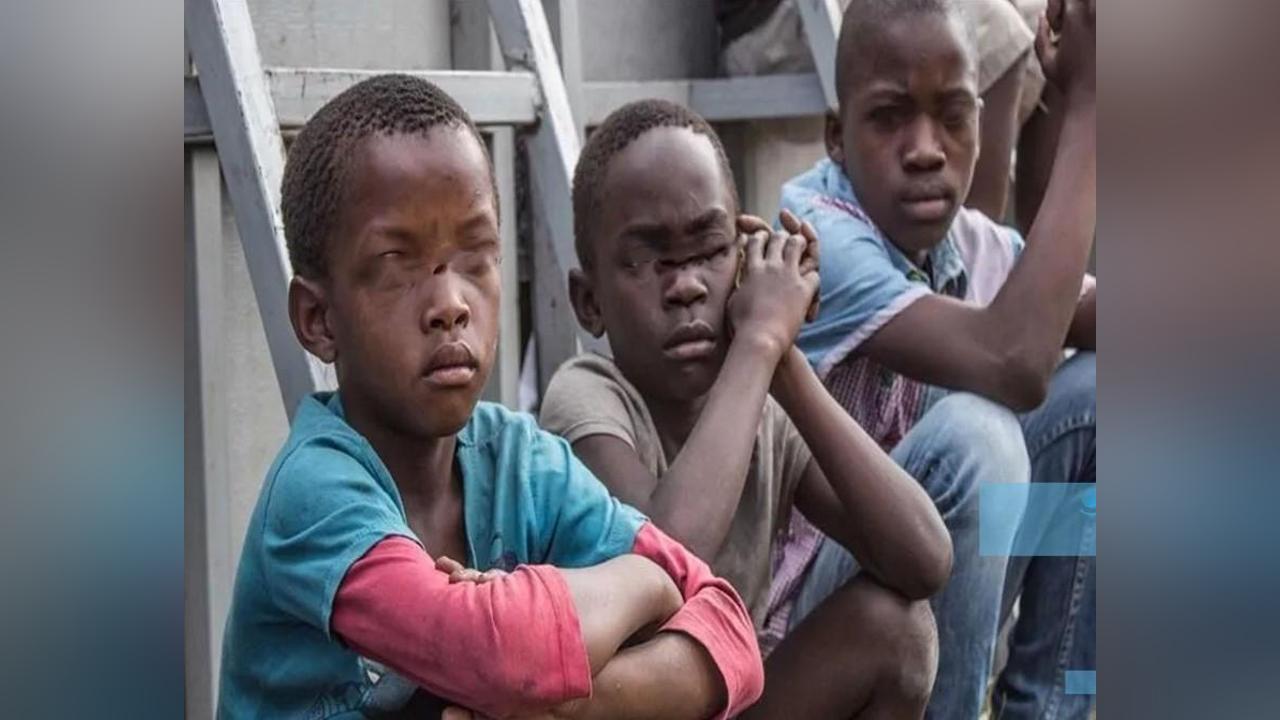 Un dispositif complémentaire de structures de base installé à Ziguinchor, Kolda, Sédhiou et Kédougou Un dispositif complémentaire de structures de base installé à Ziguinchor, Kolda, Sédhiou et Kédougou
