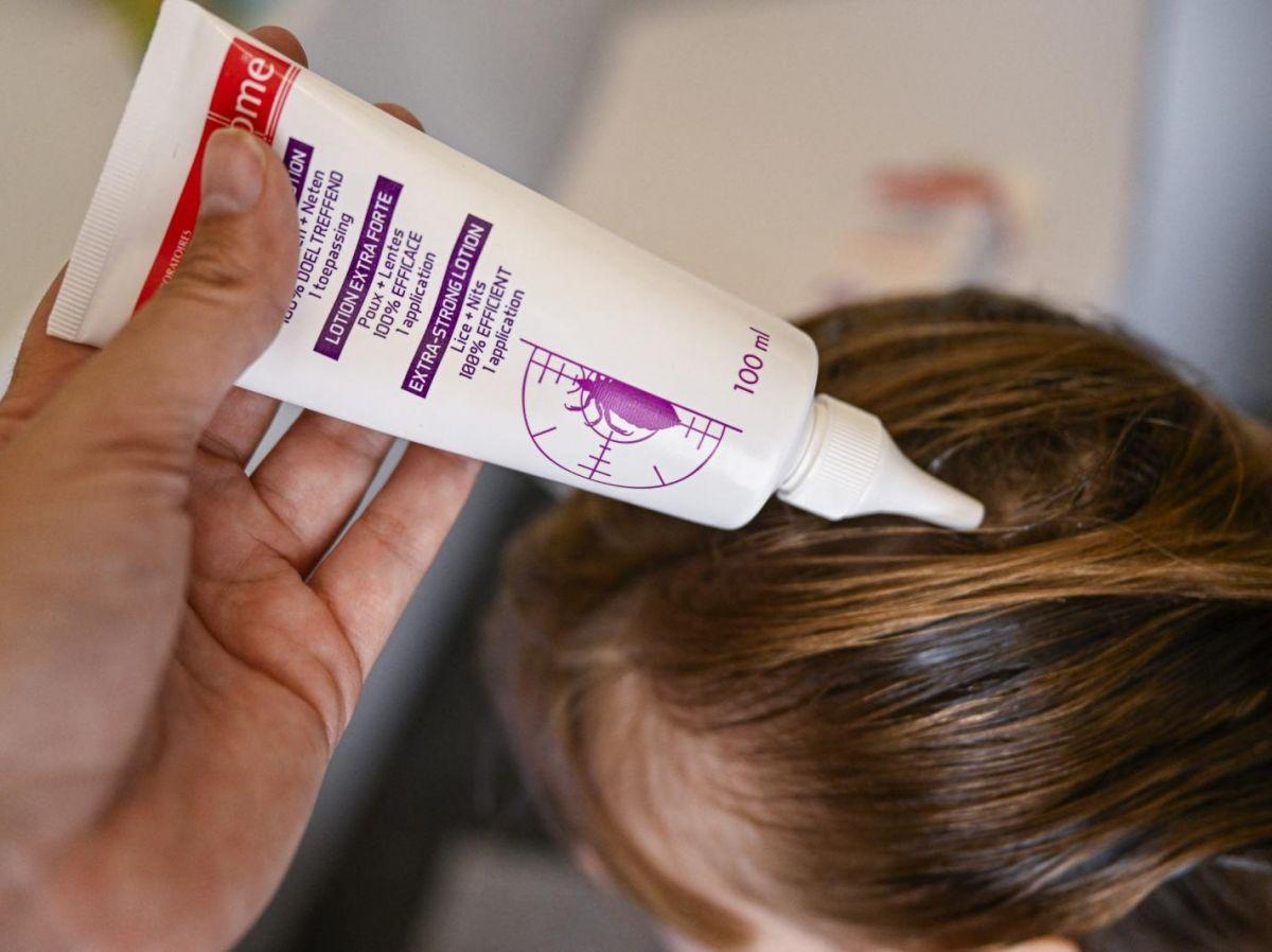 Que faire contre les poux et les lentes ? Que faire contre les poux et les lentes ?