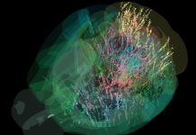 Prise de Décision: le Cerveau S’Illumine comme un Sapin Prise de Décision: le Cerveau S’Illumine comme un Sapin