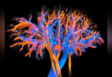 Sonde Ultrasonore Visualise Circulation Sanguine en 4D Sonde Ultrasonore Visualise Circulation Sanguine en 4D