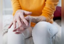 Polyarthrite RhumatoïDe: Définition SymptôMes Traitement Polyarthrite RhumatoïDe: Définition SymptôMes Traitement