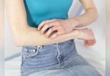 Les Démangeaisons Sont-Elles une Forme de Douleur? Les Démangeaisons Sont-Elles une Forme de Douleur?