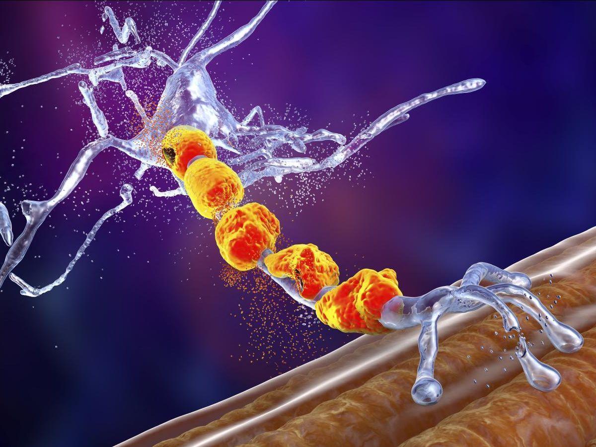 Maladie de Charcot: Origine des Protéines Toxiques Maladie de Charcot: Origine des Protéines Toxiques