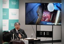 Japon Approuve Traitement par Cellules Souches Parkinson Japon Approuve Traitement par Cellules Souches Parkinson