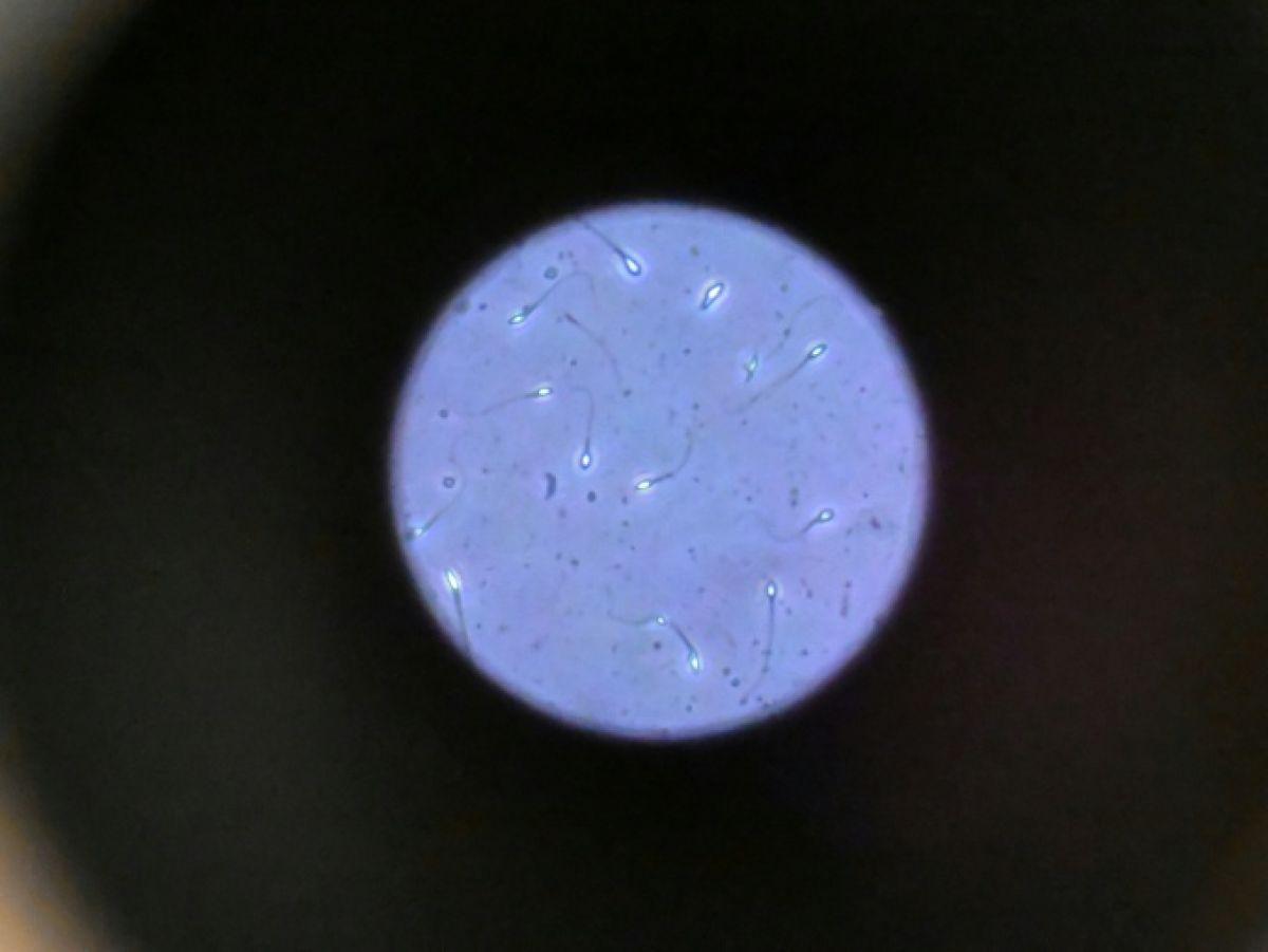 Spermatozoïdes Difficiles à Orienter Dans l’Espace Spermatozoïdes Difficiles à Orienter Dans l’Espace