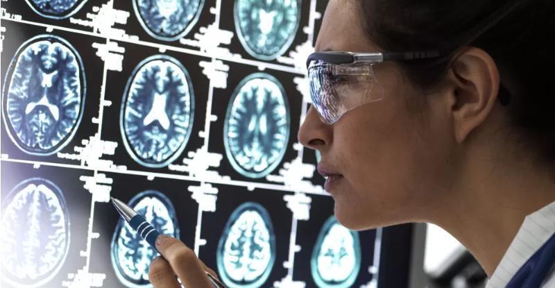 Scientists discover how brain cells die in Alzheimer’s Scientists discover how brain cells die in Alzheimer’s