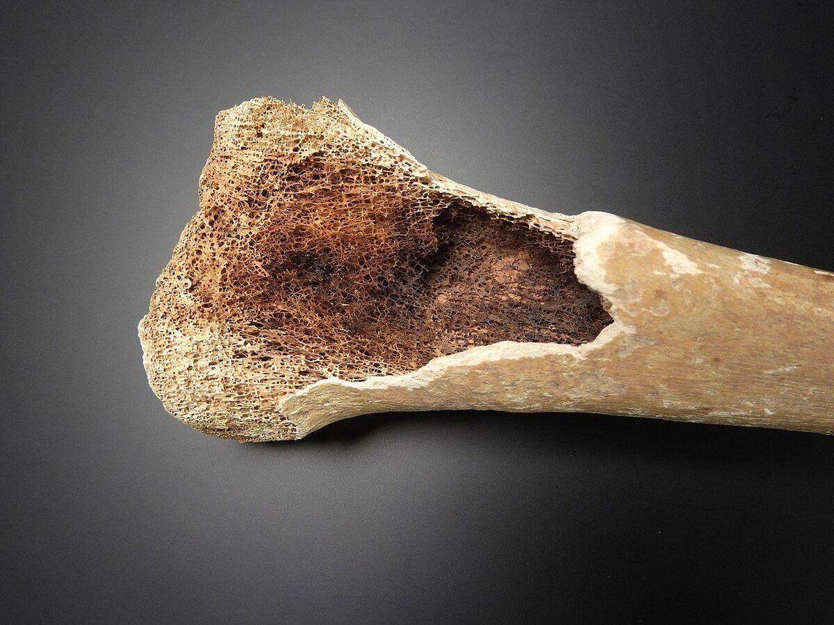 Russian Scientists Develop Advanced Material for Bone Healing Russian Scientists Develop Advanced Material for Bone Healing