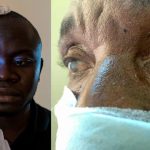 Ministry of Health Launches Free Cataract Surgery Program Ministry of Health Launches Free Cataract Surgery Program