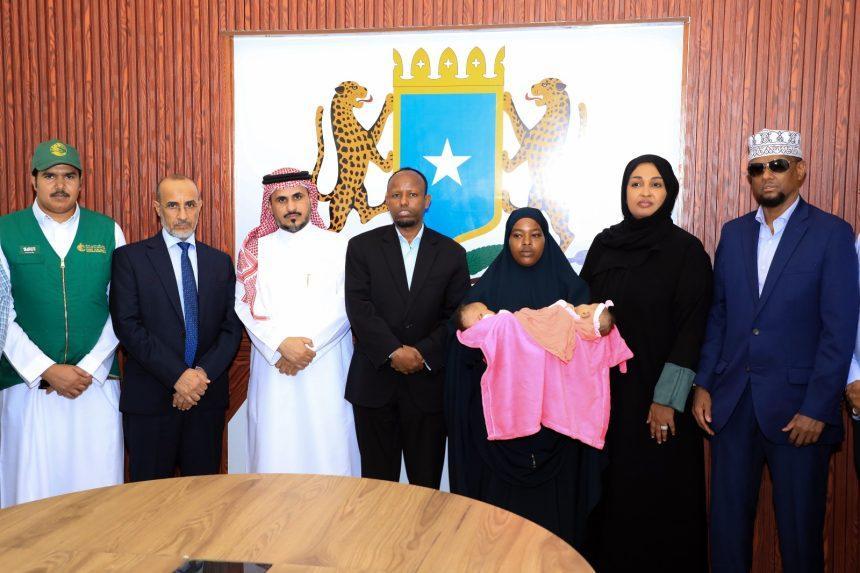 نقل توأمتين صوماليتين ملتصقتين إلى الرياض لإجراء عملية فصل