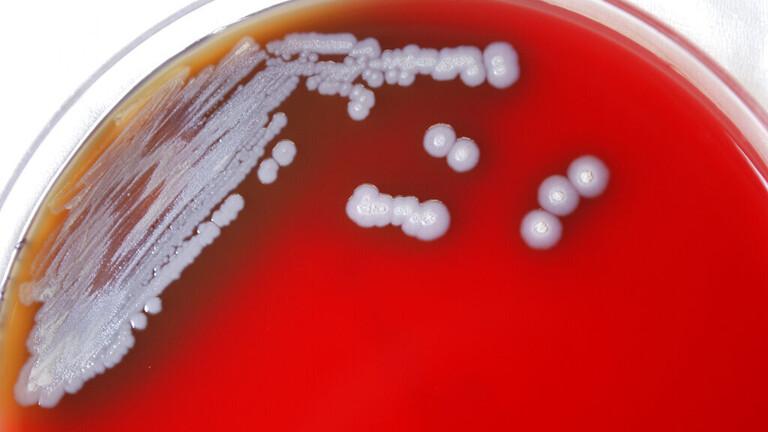 المراكز الأمريكية للسيطرة على الأمراض تعلن العثور على بكتيريا قاتلة في البلاد