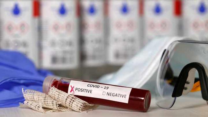 Covid-19 in SA: 247 more die, 9 199 new infections Covid-19 in SA: 247 more die, 9 199 new infections