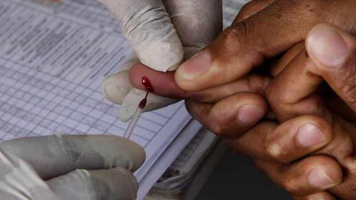 HIV, a forgotten pandemic during Covid-19 HIV, a forgotten pandemic during Covid-19