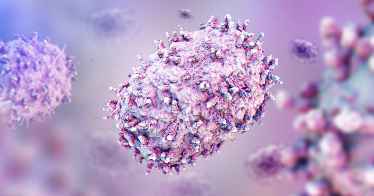 Mpox cases in SA rises to 25 Mpox cases in SA rises to 25