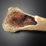 Russian Scientists Create Advanced Bone Healing Material Russian Scientists Create Advanced Bone Healing Material