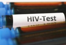 Health Department Urged to Ensure HIV Rollout Accountability Health Department Urged to Ensure HIV Rollout Accountability