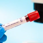 Gauteng Malaria Cases Imported From High-Risk Areas Gauteng Malaria Cases Imported From High-Risk Areas