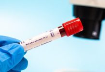 Gauteng Malaria Cases Imported From High-Risk Areas Gauteng Malaria Cases Imported From High-Risk Areas