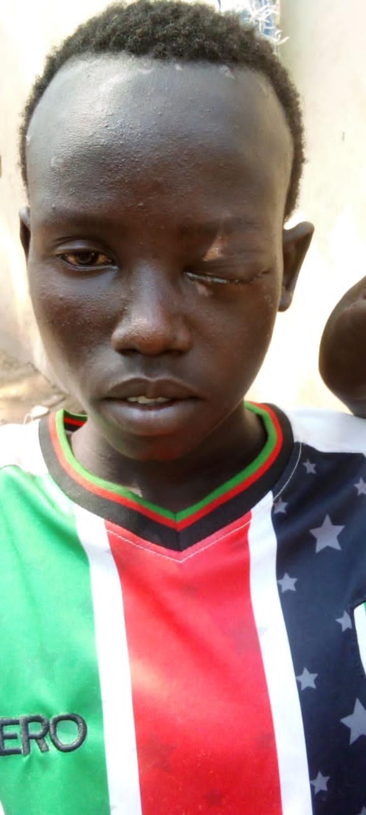 16 year old Boy s Eye Removed After Toronto Boys Brutality South Sudan