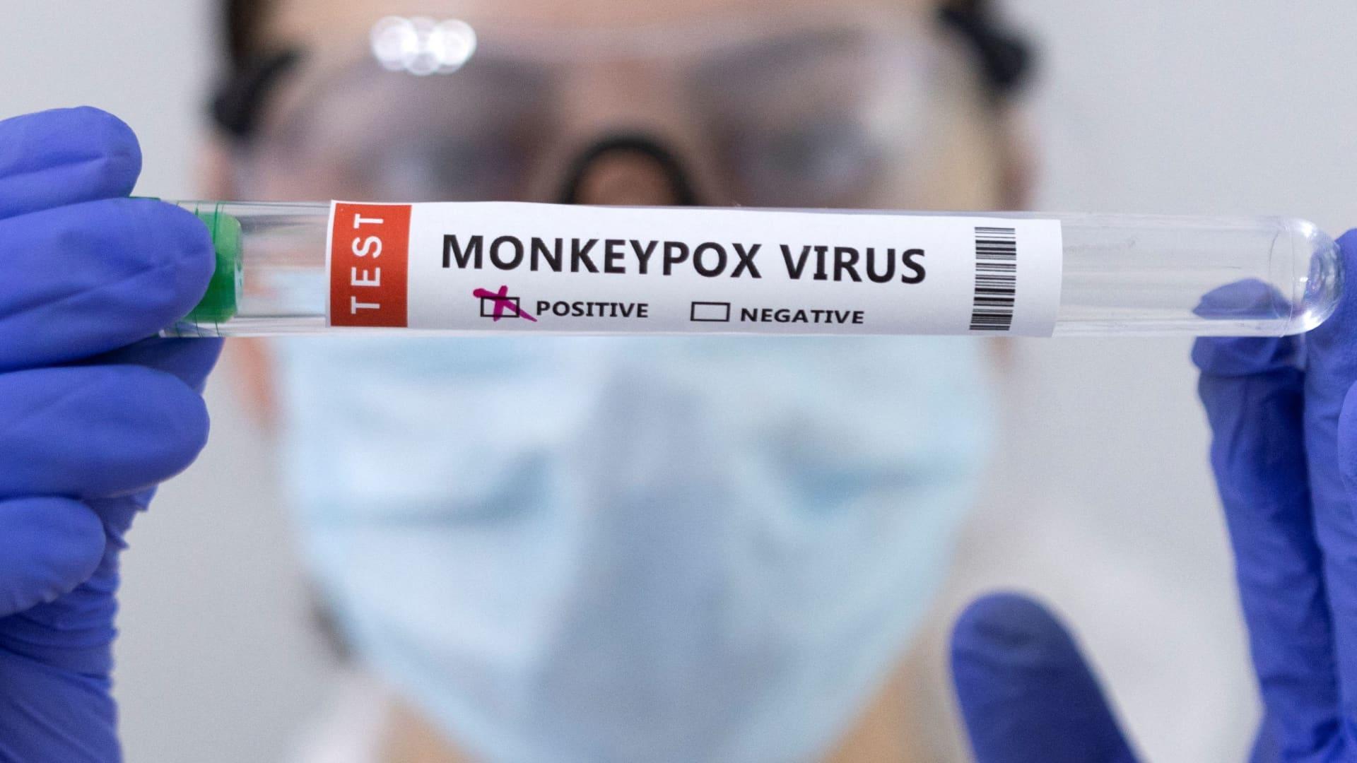 S. Sudan on alert as Congo, Sudan record monkeypox cases