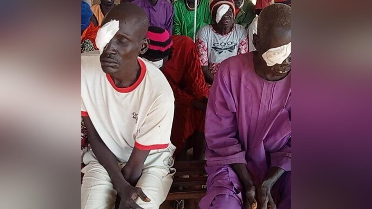 200 individuals to receive free eye surgeries in Bentiu IDP camp 200 individuals to receive free eye surgeries in Bentiu IDP camp