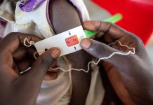 Malnourished Children at Risk Amid Escalating Violence Malnourished Children at Risk Amid Escalating Violence