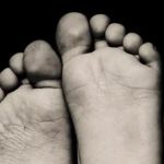 Cure for Chronic Diabetic Foot Ulcers Found Cure for Chronic Diabetic Foot Ulcers Found