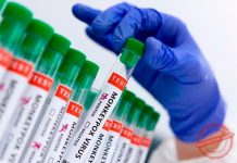 Western Equatoria records 19 Mpox cases since outbreak Western Equatoria records 19 Mpox cases since outbreak