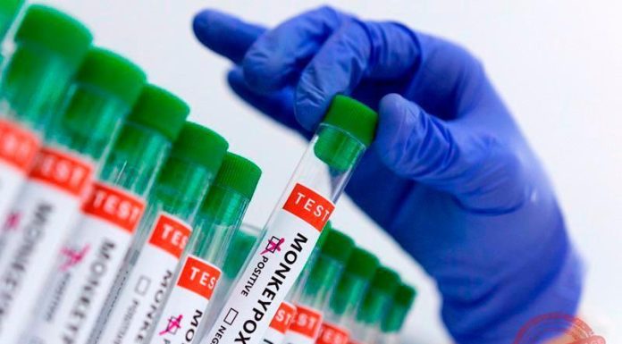 Western Equatoria records 19 Mpox cases since outbreak Western Equatoria records 19 Mpox cases since outbreak