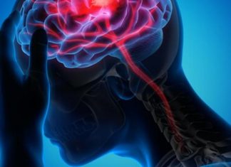 سبع علامات للجلطة الدماغية الصامتة سبع علامات للجلطة الدماغية الصامتة