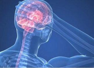 6 أشياء يجب القيام بها لتجنب نوبات الصداع 6 أشياء يجب القيام بها لتجنب نوبات الصداع