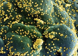 الصحة السودانية تسعى لمعرفة نوع سلالة فيروس كورونا المنتشر بالبلاد الصحة السودانية تسعى لمعرفة نوع سلالة فيروس كورونا المنتشر بالبلاد