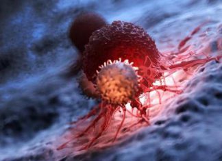 ارتفاع مستوى الكوليسترول في الدم بزيد عدوانية سرطان المثانة ارتفاع مستوى الكوليسترول في الدم بزيد عدوانية سرطان المثانة