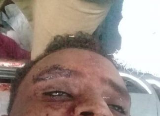 عاجل: ارتقاء شهيد شهيد في مستشفى شرق النيل عاجل: ارتقاء شهيد شهيد في مستشفى شرق النيل