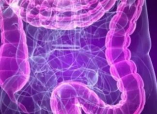 طريقة جديدة لعلاج التهاب الأمعاء طريقة جديدة لعلاج التهاب الأمعاء