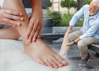 علامة منذرة لنقص فيتامين B12 في الساقين علامة منذرة لنقص فيتامين B12 في الساقين