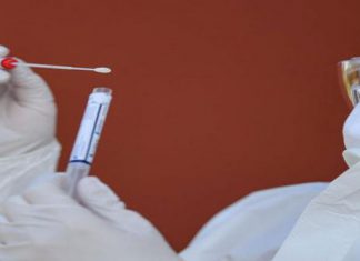اختبارات كورونا قد تفشل في اكتشاف “أوميكرون” اختبارات كورونا قد تفشل في اكتشاف "أوميكرون"