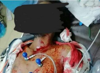 لجنة الأطباء تعلن إرتقاء شهيد جديد من مليونية اليوم 24 يناير لجنة الأطباء تعلن إرتقاء شهيد جديد من مليونية اليوم 24 يناير