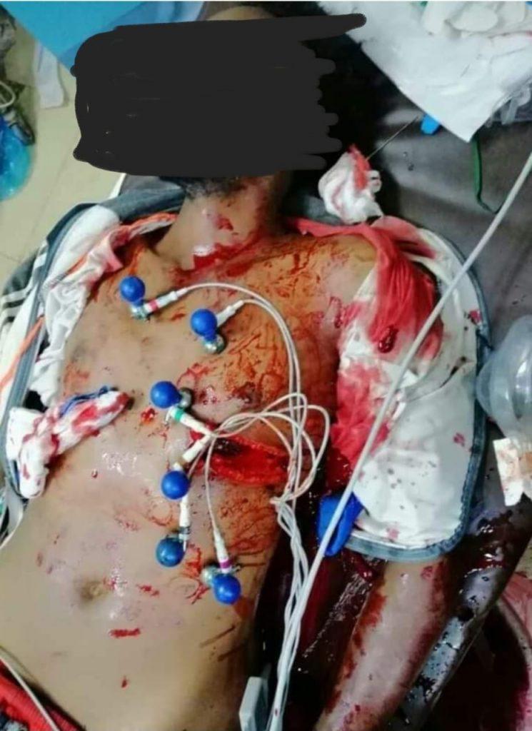 لجنة الأطباء تعلن إرتقاء شهيد جديد من مليونية اليوم 24 يناير لجنة الأطباء تعلن إرتقاء شهيد جديد من مليونية اليوم 24 يناير