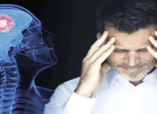 دراسة: كورونا الخفيف قد يترك آثارا سلبية بالدماغ دراسة: كورونا الخفيف قد يترك آثارا سلبية بالدماغ