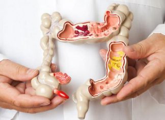 كيف تواجه القولون العصبي كيف تواجه القولون العصبي