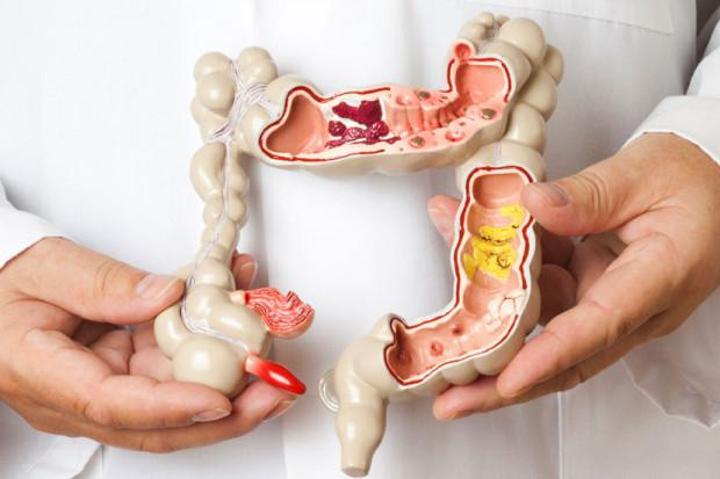 كيف تواجه القولون العصبي كيف تواجه القولون العصبي