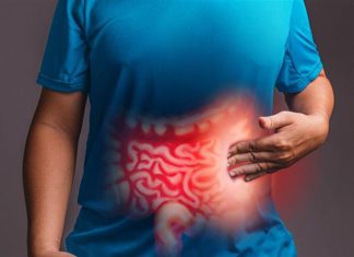 عوامل تزيد خطر الإصابة بسرطان القولون عوامل تزيد خطر الإصابة بسرطان القولون