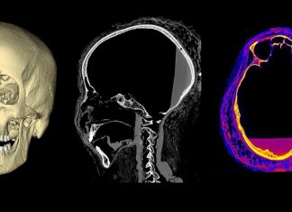 المرأة الحامل صاحبة المومياء الغامضة.. ربما ماتت بالسرطان المرأة الحامل صاحبة المومياء الغامضة.. ربما ماتت بالسرطان