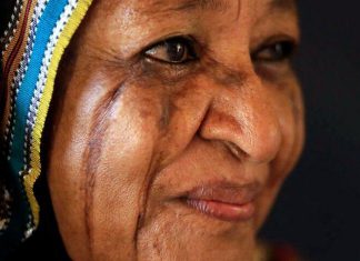 “الشلوخ” … عادة قبلية قديمة تشوه الوجوه اندثرت في السودان “الشلوخ” … عادة قبلية قديمة تشوه الوجوه اندثرت في السودان